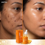 Sérum Facial Vitamina C (30ml) — Brilho Real, Resultado Visível